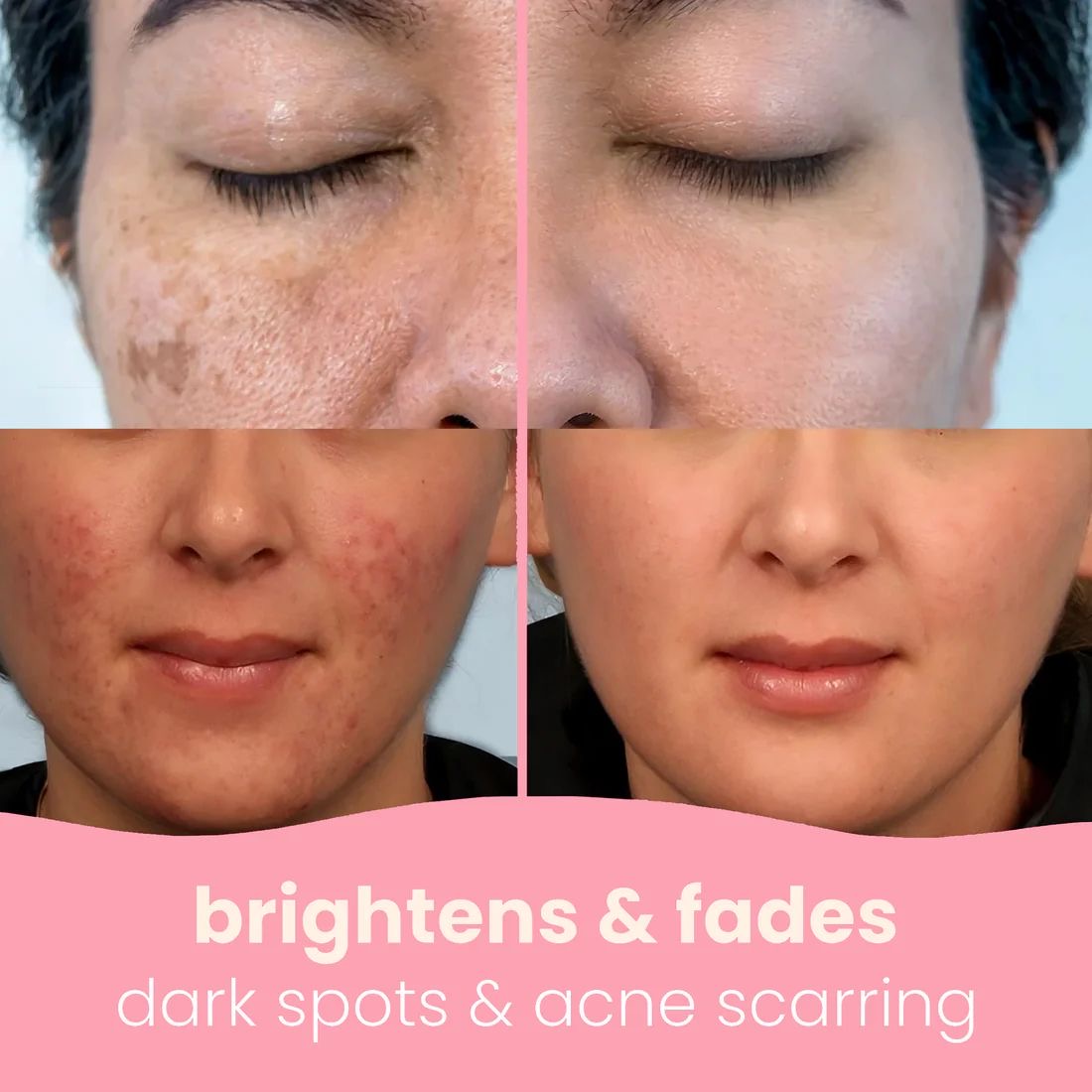 TURMERIC & KOJIC ACID PADS (40 pads)