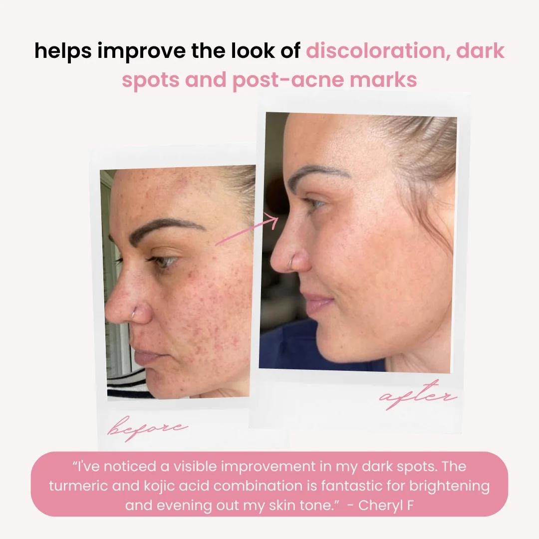 TURMERIC & KOJIC ACID PADS (40 pads)