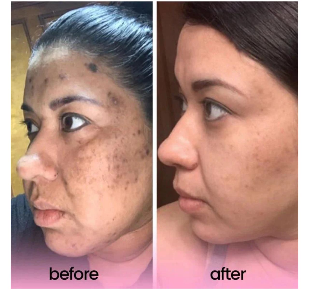 The Ultimate Glow Booster Bundle