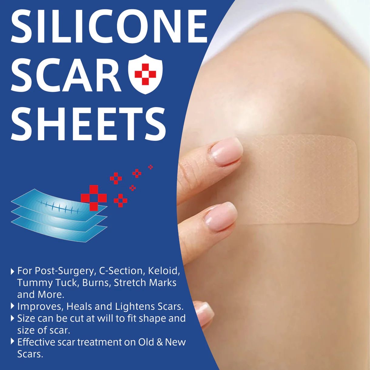 Silicone Scar Sheets