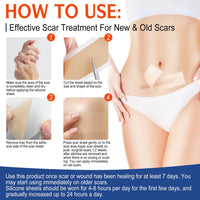 Silicone Scar Sheets