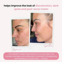The Ultimate Glow Booster Bundle