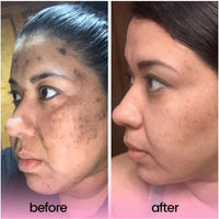 The Ultimate Glow Booster Bundle